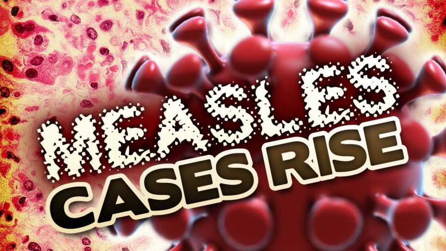 Measles Virus Moves To Houston